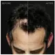 Toppik Hair Building Fibers Giant Size Dark Brown 55 g, bilde 4